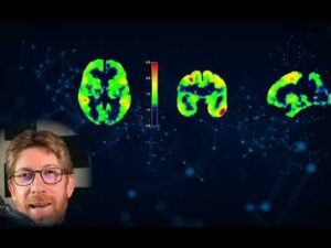 Vista de tres cortes axiales cerebrales mostrados como mapas de calor característicos de una tomografía por emisión de positrones con barra de escala de colores sobre un fondo oscuro con patrones de conexiones neuronales y la imagen de una persona con gafas en la esquina, Tomografía por emisión de positrones ventajas y desventajas clave