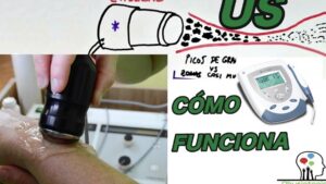 ultrasonido terapeutico