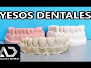 Modelos de yeso dental de varias arcadas en tonos rosa, blanco y beige sobre una mesa con fondo azul, acompañados por texto superior que anuncia YESOS DENTALES y un logotipo en la esquina, Ventajas y desventajas del yeso dental en odontología